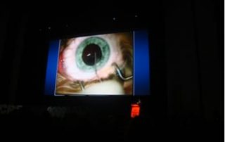 European Society of Cataract & Refractive Surgeons Mohammed Muhtaseb iLase Wales